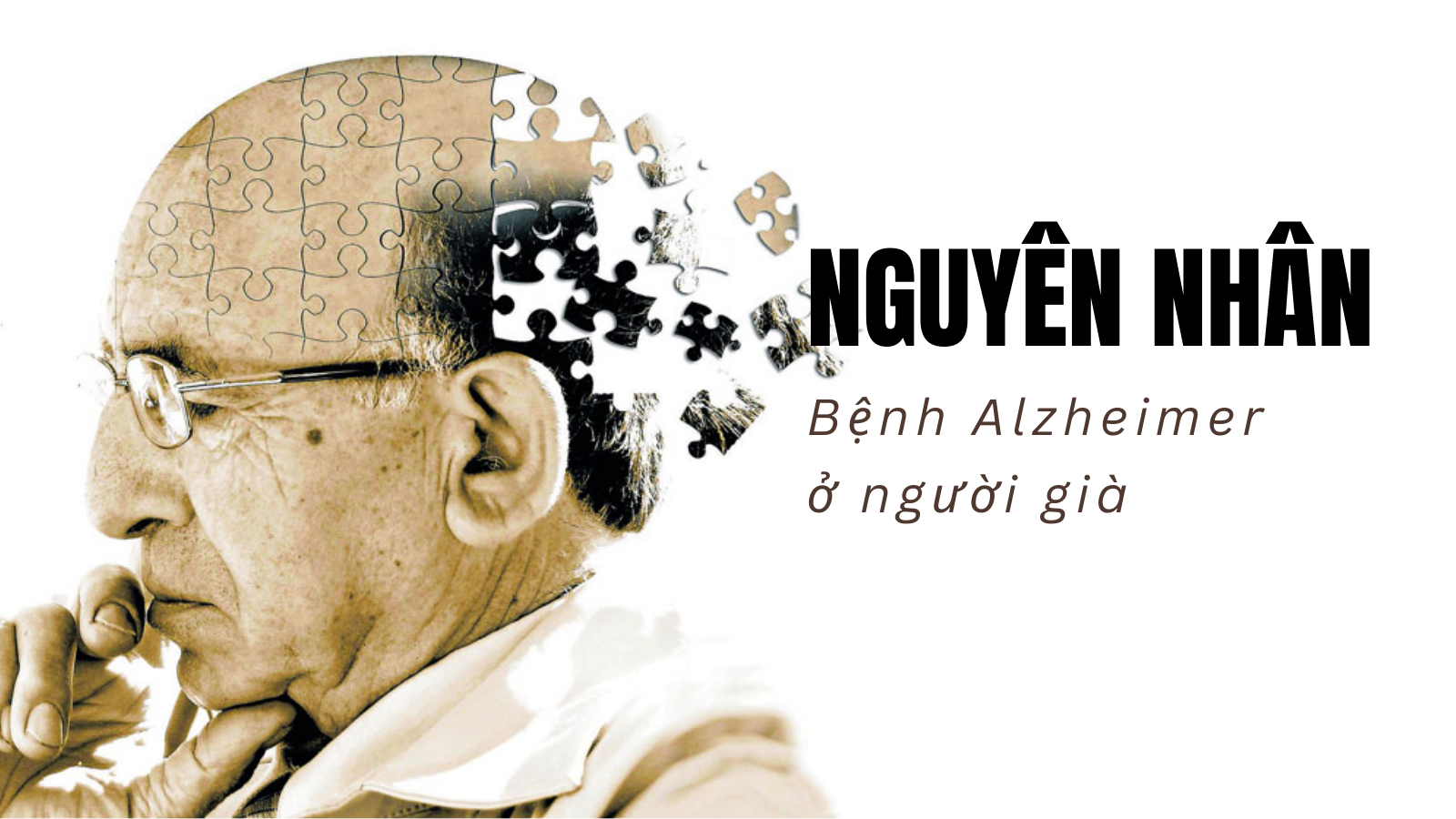 Nguyên nhân bệnh Alzheimer ở người già